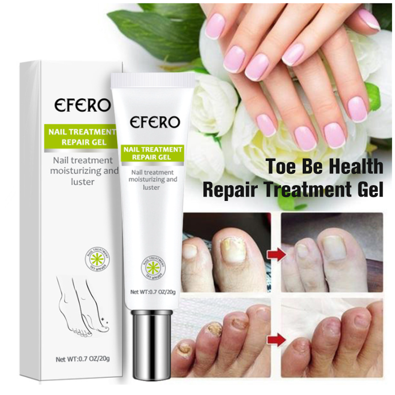 Nail Repair Treatment Gel