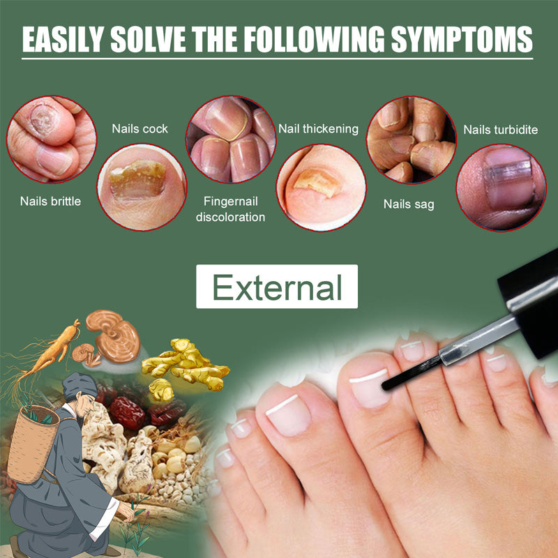 Fungal Nail Treatment