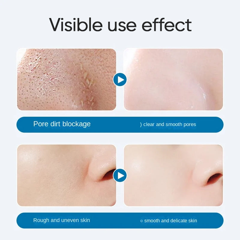 Tokyo Oligopeptide Small Bubble Cleaning Essence 10pcs
