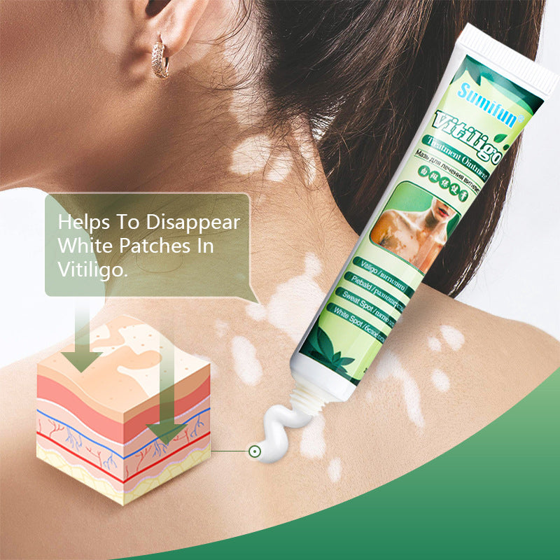 Vitiligo Health Repair Crem