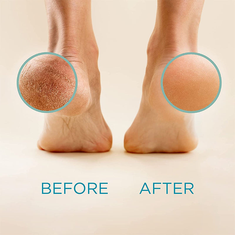 Feet Scraper Pedicure Tool
