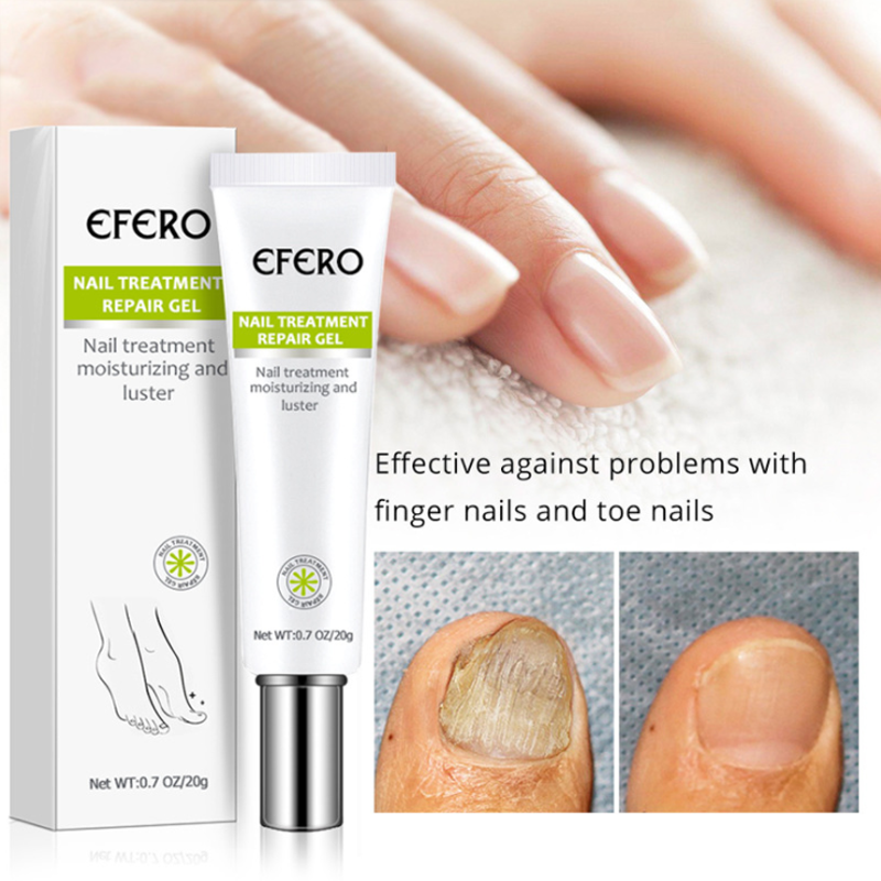 Nail Repair Treatment Gel