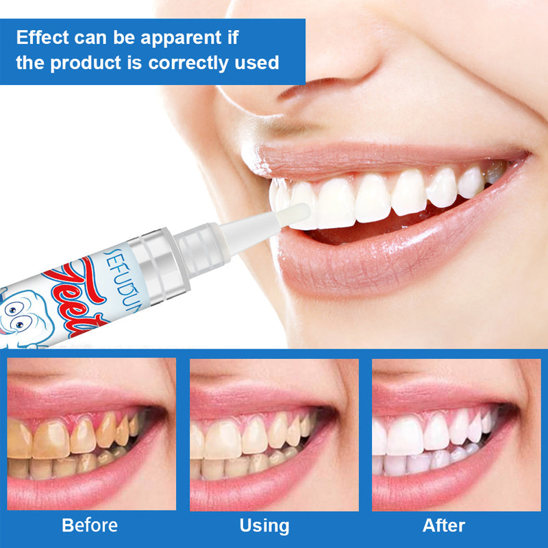 Teeth Whitening Gel Pen