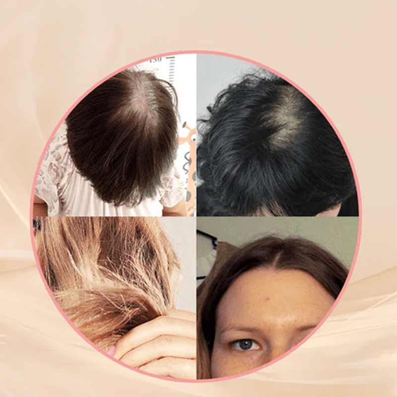 Hair Clip in Bangs for Women