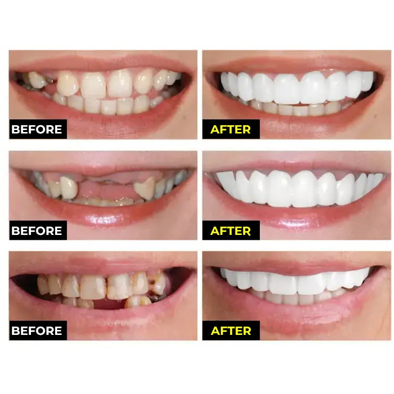 Practical Teeth Whitening Stickers