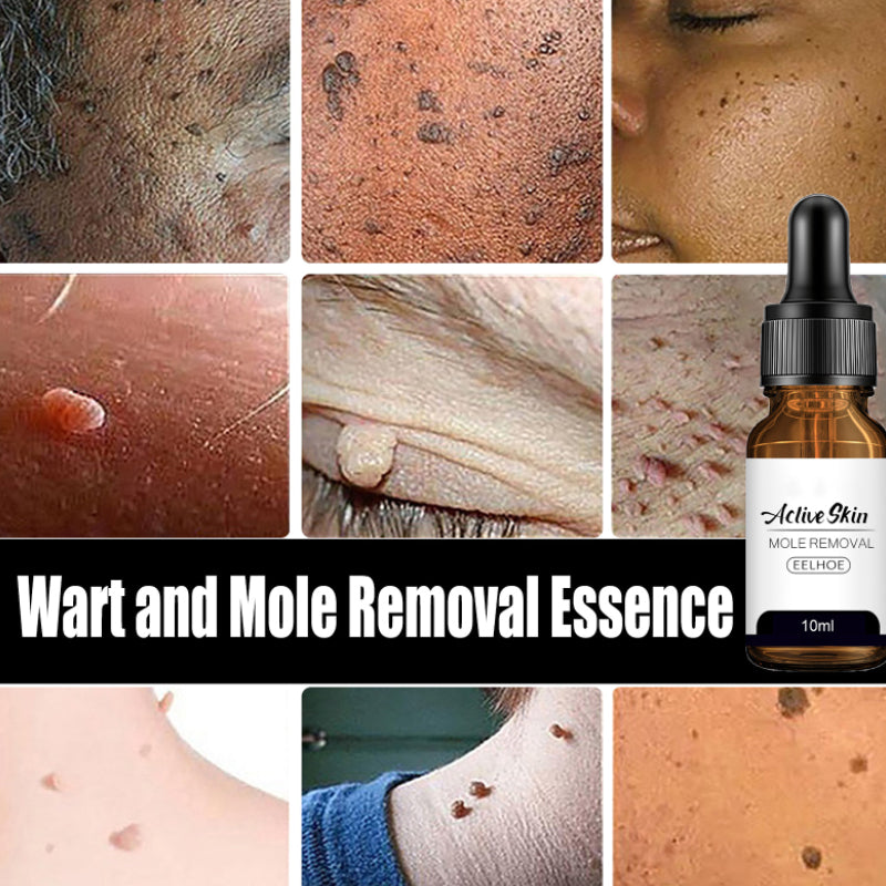 Mole and Wart Essence