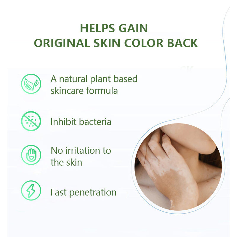 Vitiligo Health Repair Crem