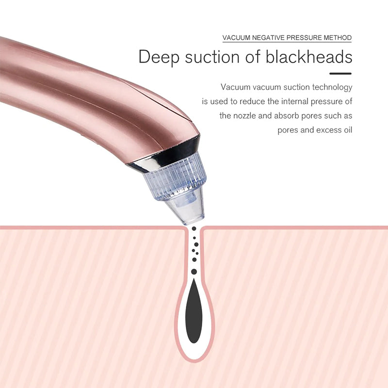 Black Head Remover