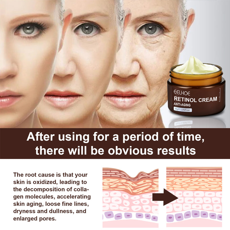 Retinol Anti Aging Face Cream