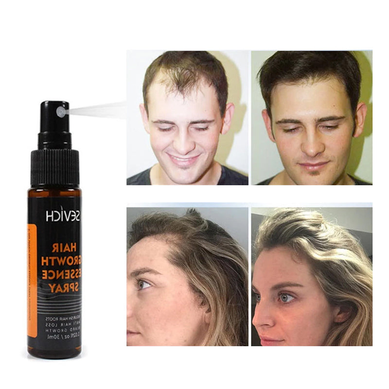 Hair Growth Essence Spray