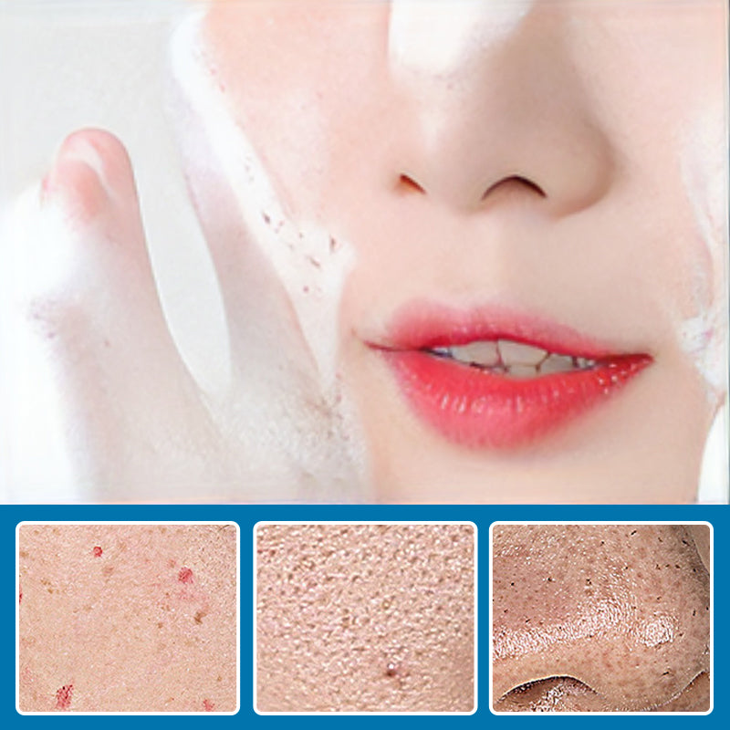 Tokyo Oligopeptide Small Bubble Cleaning Essence 10pcs