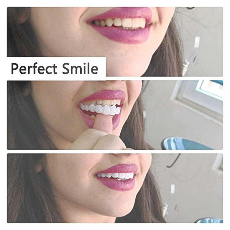 Magic Smile Teeth Brace