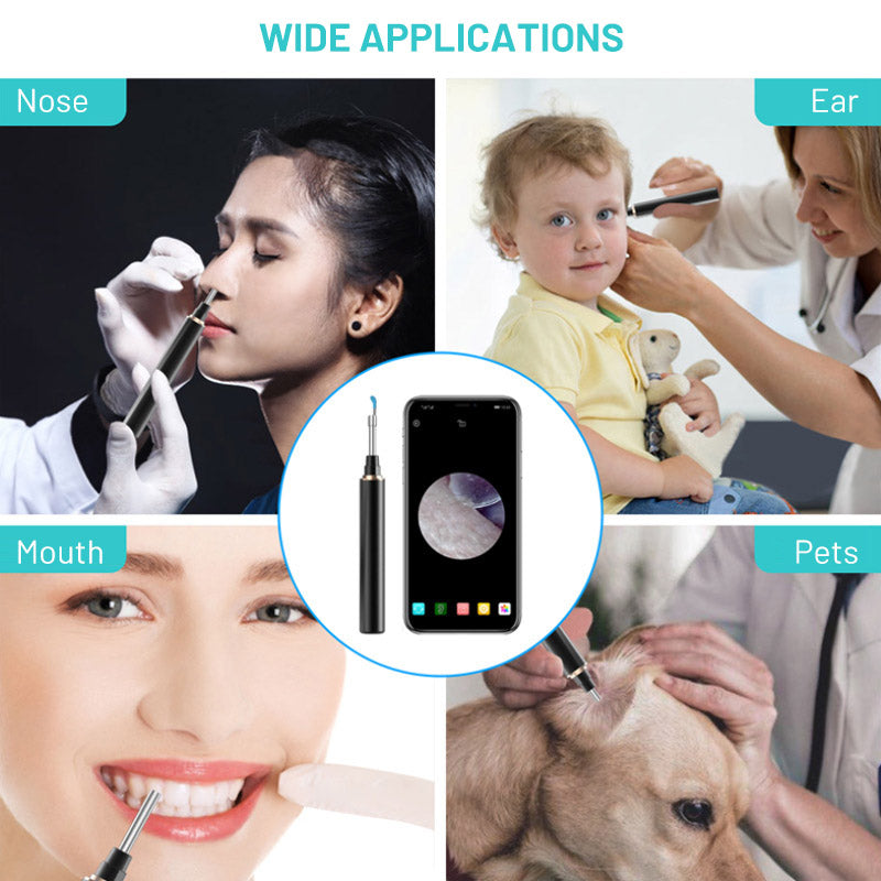 Wireless Ear Wax Removal Tool