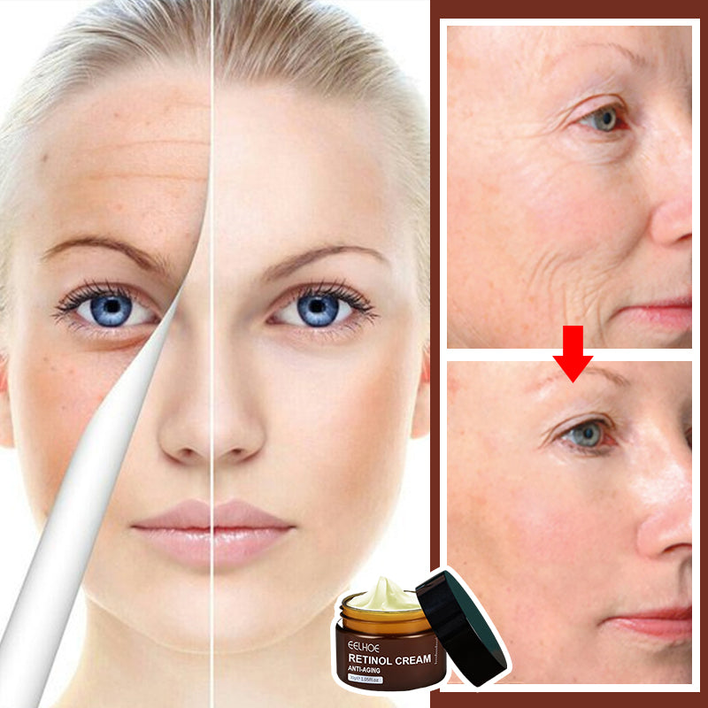 Retinol Anti Aging Face Cream