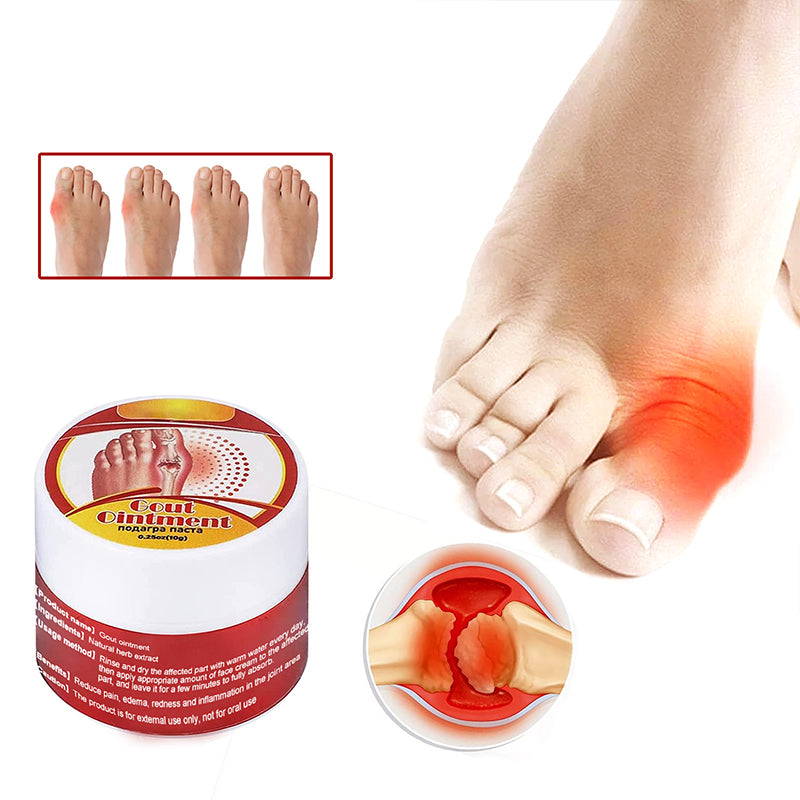 Bunion Relief Soothing Cream